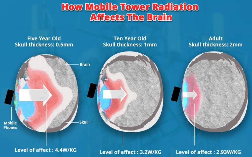 emf effects the brain